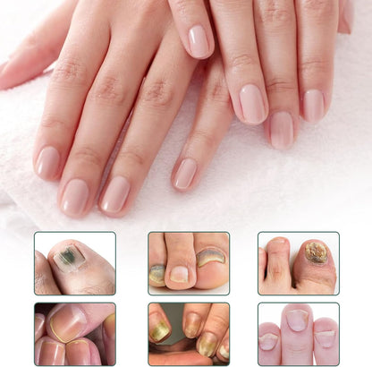 Apooliy Toenail Fungus Treatment，Nail Remedy Care for Damaged Nails and Appearance of Discolored，Nail Strengthener