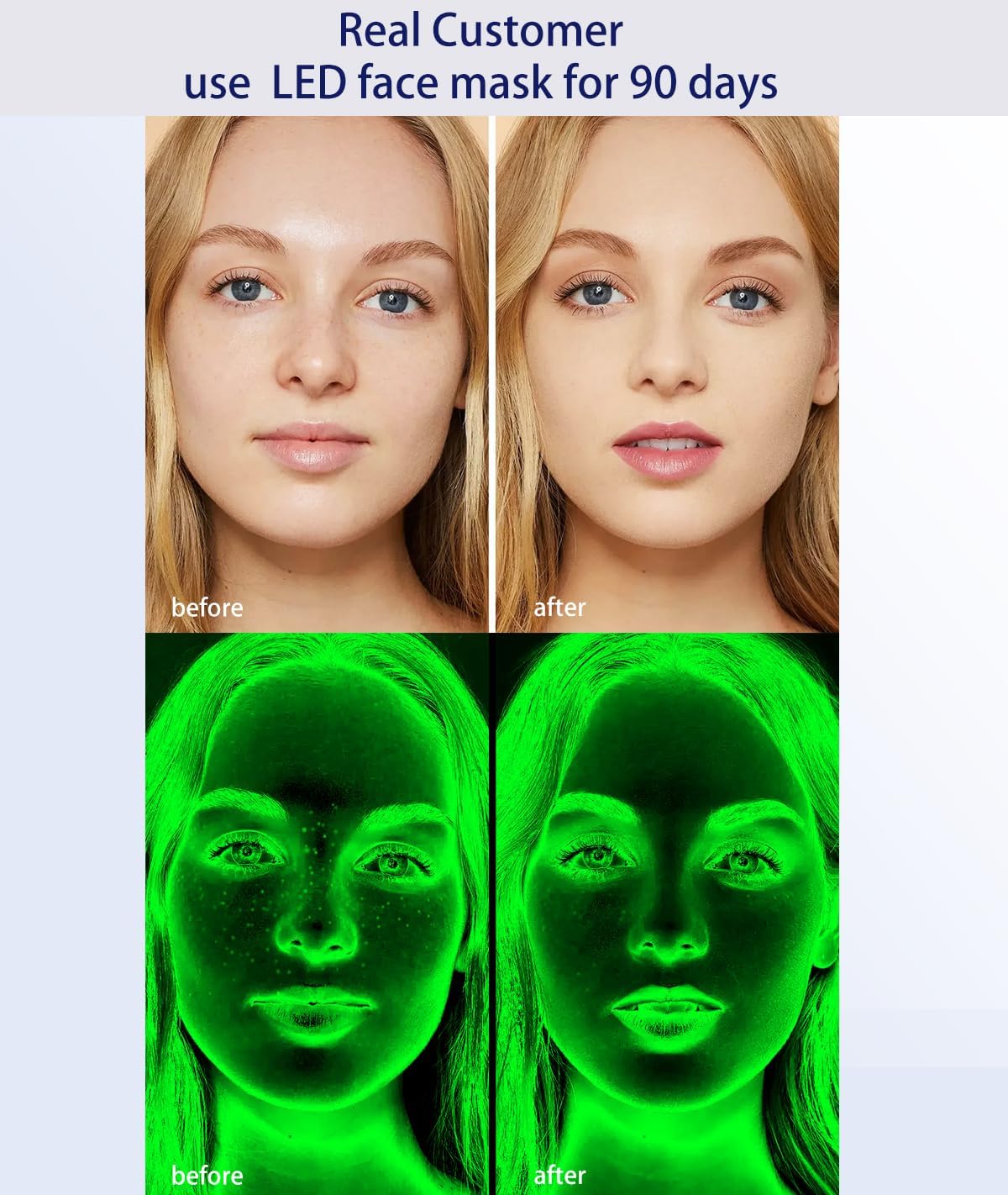 OUMEINIYA Red Light Therapy for Face Wrinkle Removal 7-in-1 Massager micro-glow facial and Neck Massager for Skin Care White