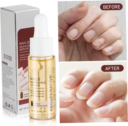Baluue Nail Strengthener 20ml Nails Repairing Serum for Nail Care Treatment Liquid