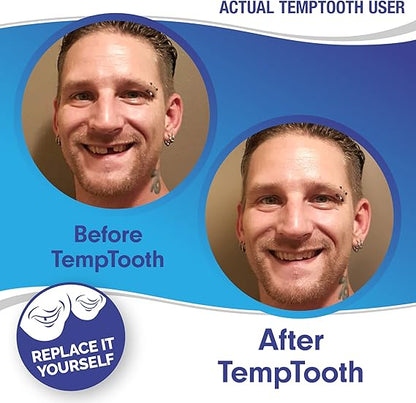 Temptooth #1 Seller Trusted Patented Temporary Tooth Replacement Product