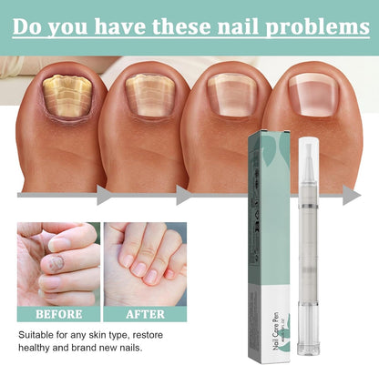 Mullend Nail Care Pen, Nail Growth Treatment Pen, Cuticle Oil with Natural Ingredients, Strengthening with Oil, Vitamin E and Aloe Vera (3 Piece)
