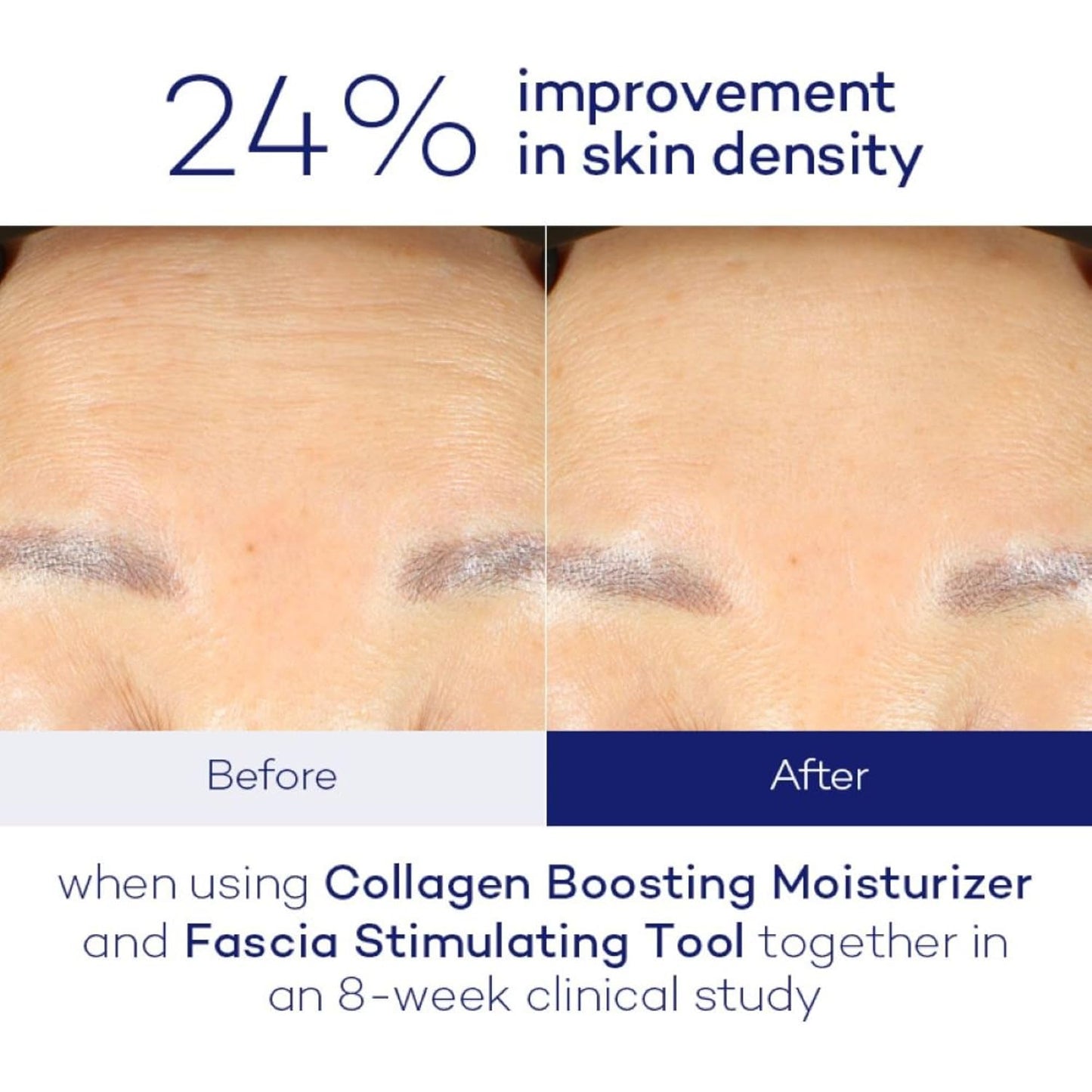 Pause Well-Aging Collagen Boosting Moisturizer - Peptide Rich Moisturizer For Skin Care - Hydrating Wrinkle Cream For Face - Made with Hyaluronic Acid, Vitamin B3 and Vitamin C - 2 fl oz