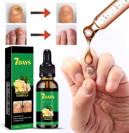 Beauras Nail Fungus Treatment, Beauras 7 Day Nail Fungus Treatment, Finger Nail Growth Serum, Ginger Cuticle Care Oil For Nails, Repair And Strengthen, Damaged, Broken, Restoring Healthy Nails (2pcs)