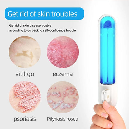 UVB Phototherapy Lamp, Irradiation Area 48 C㎡, 311 Narrow Spectrum Skin Care Device, White Spot Phototherapy Device for Skin Disorders, Body & Scalp