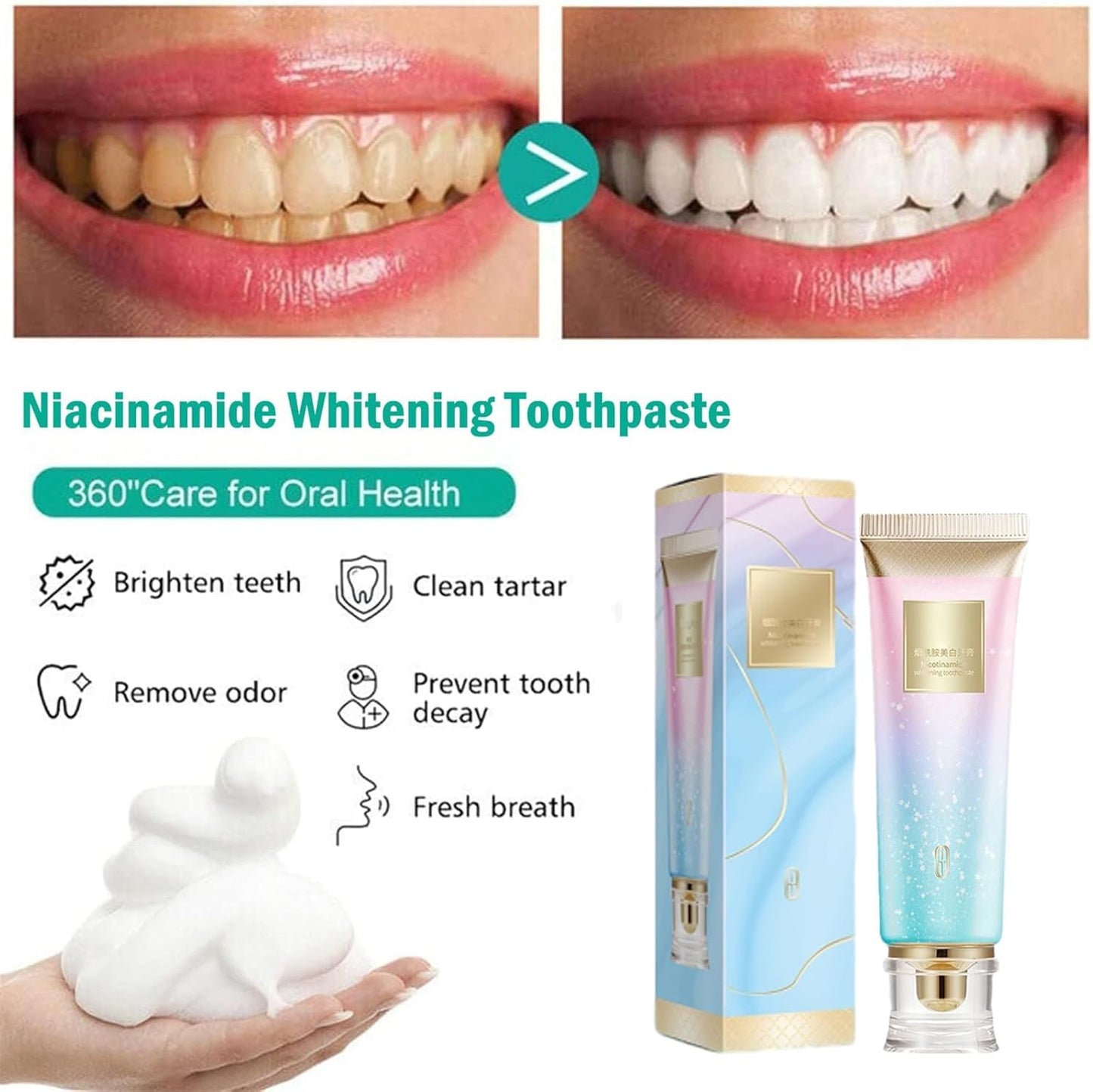Niacinamide Whitening Toothpaste, Fresh Breath Complete Care Teeth, Remove Tooth Stains, Nicotinamide Sparkling Toothpaste (1)