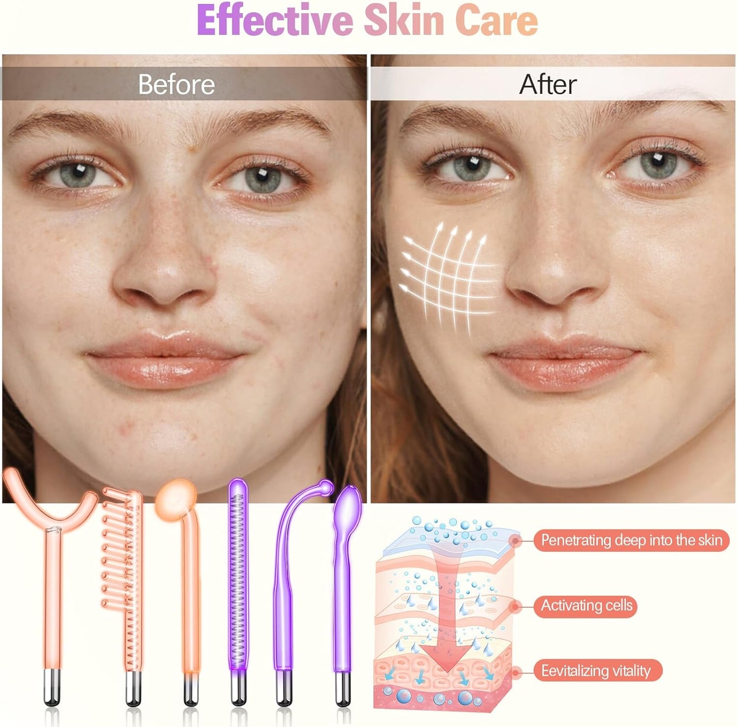 High Frequency Face Machine, 6 Pieces, Neon Gas Sticks and Argon Gas Sticks, Beauty Device for Skin Care, Acne Treatment, Skin Tightening, Wrinkle Reduction, Facial Cleanser