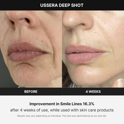 Medicube Age-R USSERA Facial Treatment Device - at-Home Skin Care Device for Collagen Stimulation Wrinkle Reduction, and Youthful Complexion - Korean Skin Care