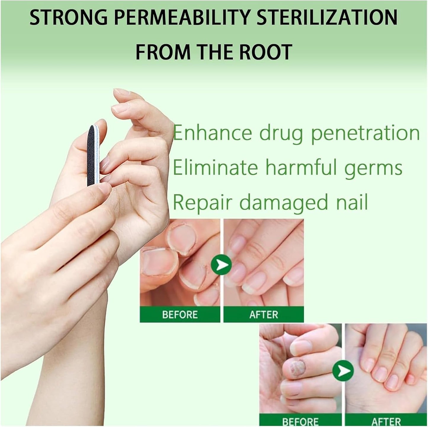 Ginger Growth Care Serum，Helps Nails Healthy Grow (2pcs)