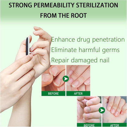 Ginger Growth Care Serum，Helps Nails Healthy Grow (2pcs)