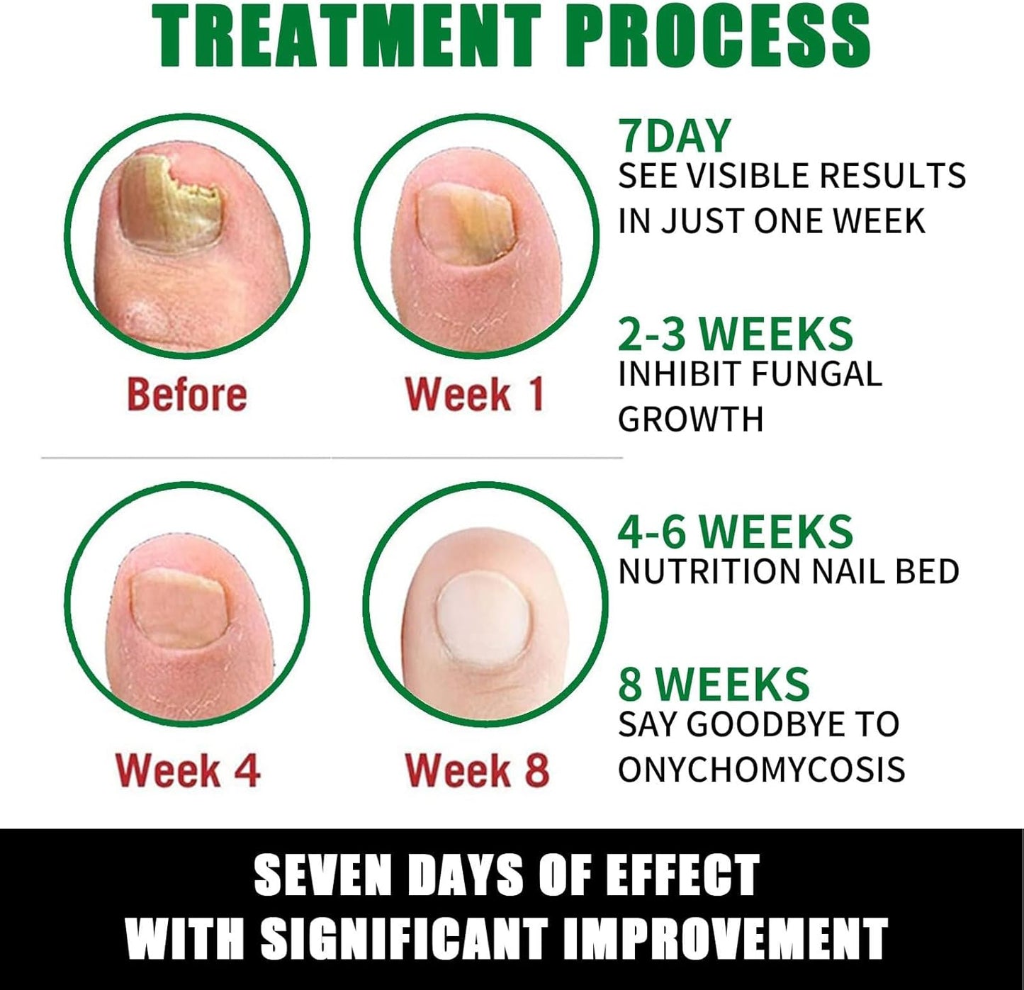 Mimoqk Organic Nail Growth Oil, 60 ml Portatile Strengthener, Professional Cuticle Care Solution, Toenail Repair Liquid, Repairing and Thickening Formula for Healthy Nails