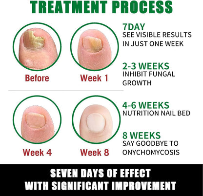 Mimoqk Organic Nail Growth Oil, 60 ml Portatile Strengthener, Professional Cuticle Care Solution, Toenail Repair Liquid, Repairing and Thickening Formula for Healthy Nails