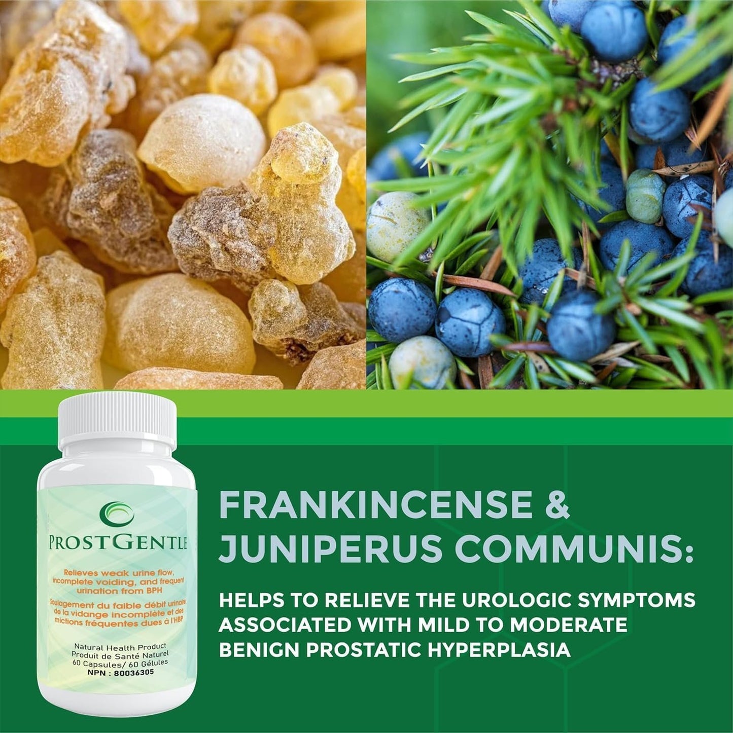 ProstGentle Relieves weak urine flow, Incomplete voiding, and frequent urination from BPH (2)