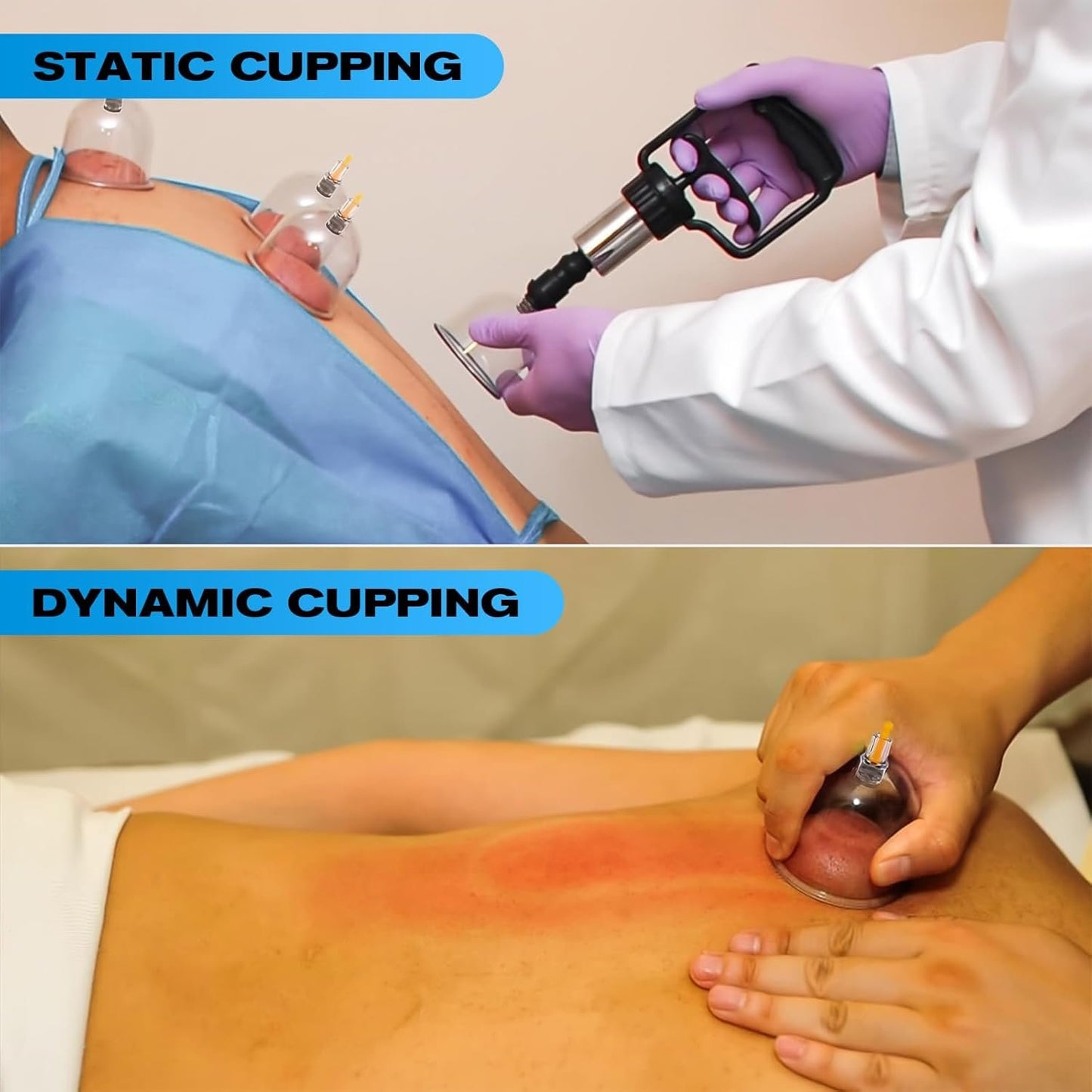 New Cupping Set - Multifunctional Cupping Therapy Kit for Massage, Professional Chinese Vacuum Cupping with Magnets, Cellulite & Muscle Pain Relief, Includes Manual Pump (13 Cups)