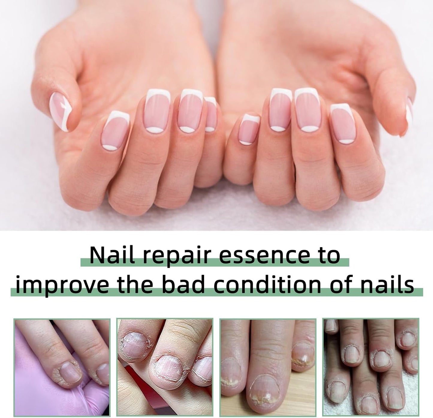 3 Pcs Nail Care Pen for Nail Care with Aloe Vera Tea Tree Oil Vitamin E Nail Growth