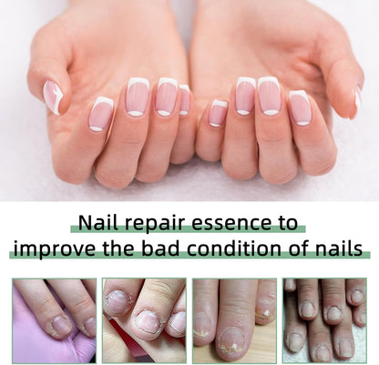 3 Pcs Nail Care Pen for Nail Care with Aloe Vera Tea Tree Oil Vitamin E Nail Growth