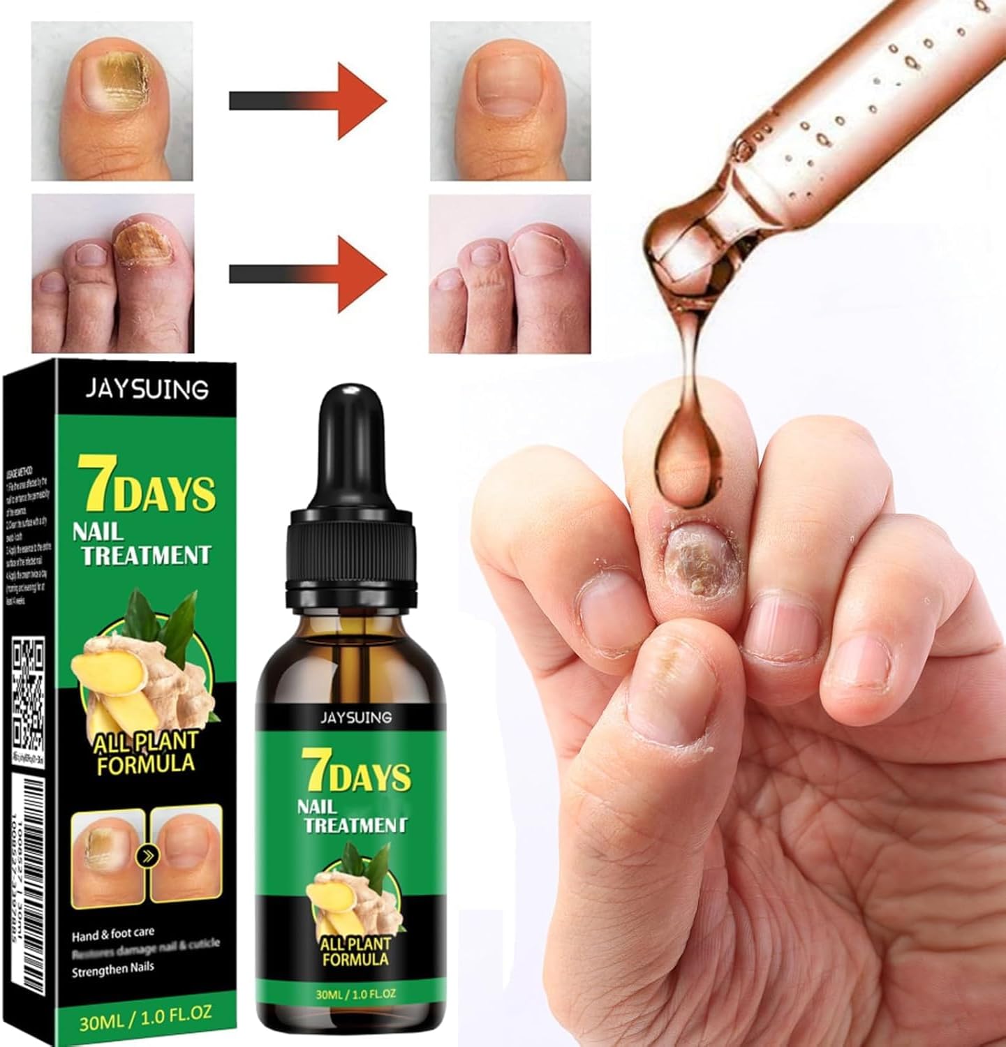 3 PCS 7 Days Ginger Nail Ginger Nail Treatment Nail Support Nail Care, Ginger Nail Growth Serum, Ginger Cuticle Care Oil for Nails, Nail Strengthener for Damaged Nails