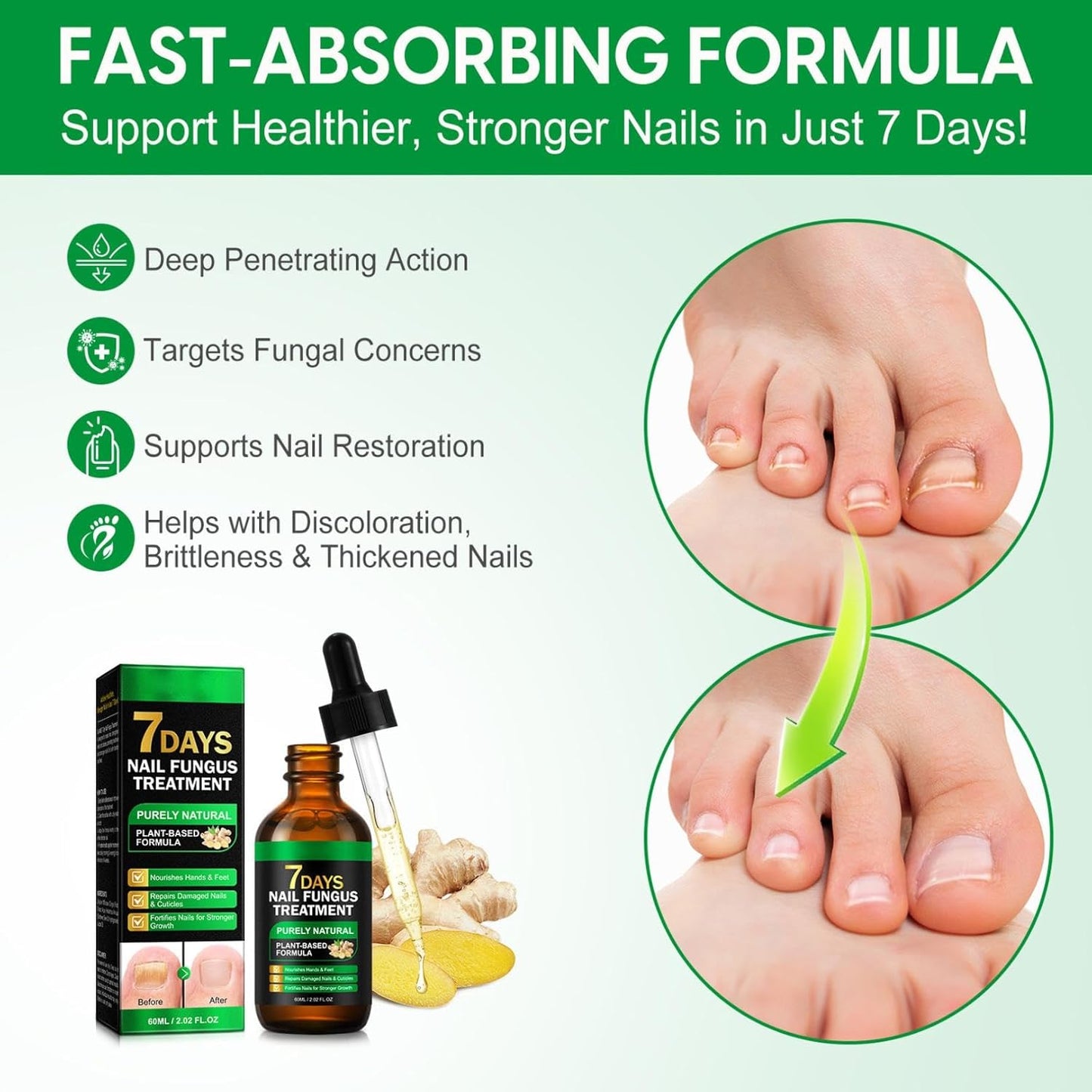 Ginger Nail Growth Serum,Ginger Nail Treatment Nail Support Nail Care,Nail Nutrient Oil Strengthener Oil,Nourishing Idratante
