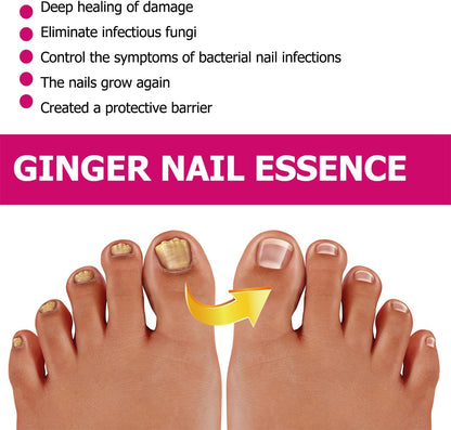 Fungigone Ginger Nail Essence, Fungigone Nail Treatment Toe, Natural Nails Fungus Treatment for Toenail & Foot Care, Regenerate Nails and Heal Wounds & Cracks (2 PCS)