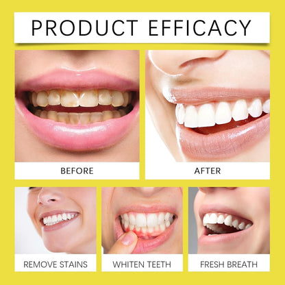 Polvere Sbiancante For Denti Oral Care - Alito Fresco, Rimozione Delle Macchie E Igiene Orale, Soluzione For La Pulizia Dei Denti Facile Da Usare(3PCS)