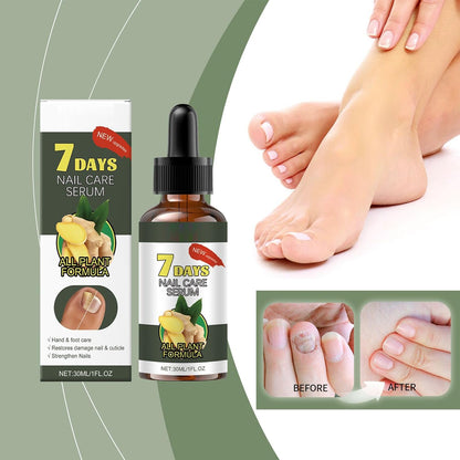 Natural Nail Care Moisturizer, Professional Nail Growth Corrector, Quick-Absorb Formula, 30 ml Idratazione Trattamenti, Adatto per donne anziane, Home Salon Travel Use