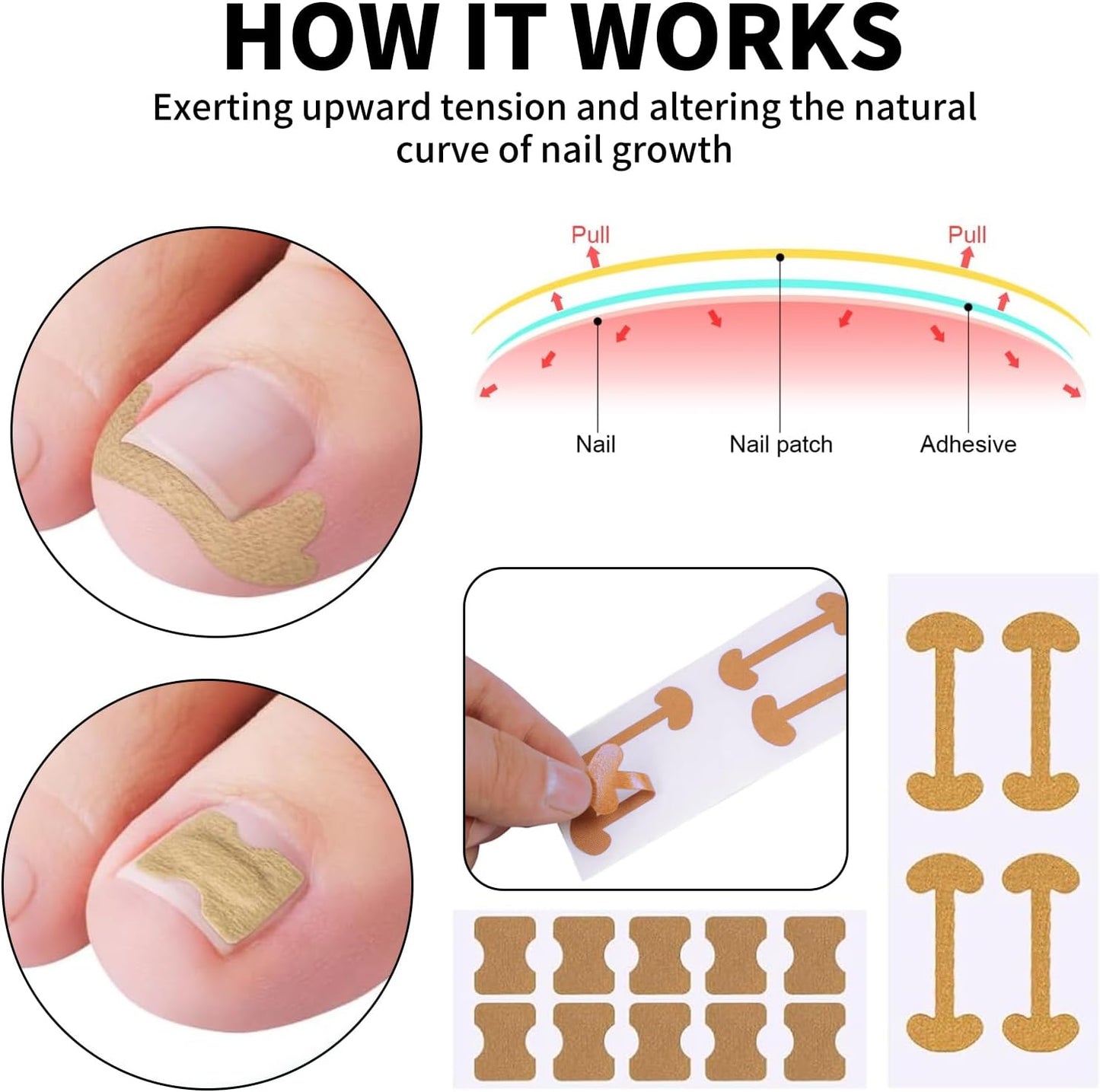 Oiieco 114 PCS Ingrown Toenail Treatment Kit with Corrector Strips,Nail Clippers & Tools,Professional Pain Relief for Ingrowing Toenails