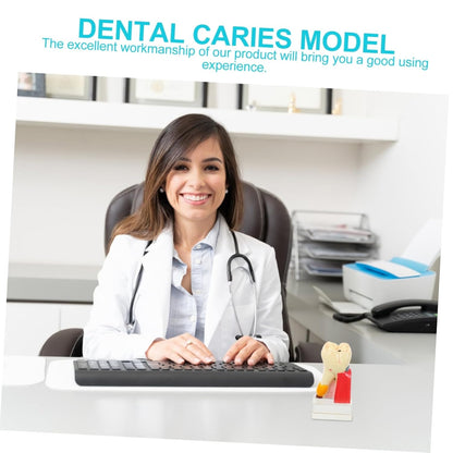 KICHOUSE 4 Caries Model Tooth Model Demonstration Model Teeth Model Teaching Oral Model Toy Teeth for Teeth Models for Education Model