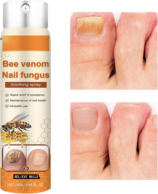 Nail Care Liquid, Nail Repair Renewal Spray Solution, 1.02x1.02x4.06 Inches Portable Bottle, Soothing Toenail for Damaged Nails, Men, Women, Adults, Easy to Use