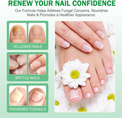 Ginger Nail Growth Serum,Ginger Nail Treatment Nail Support Nail Care,Nail Nutrient Oil Strengthener Oil,Nourishing Idratante