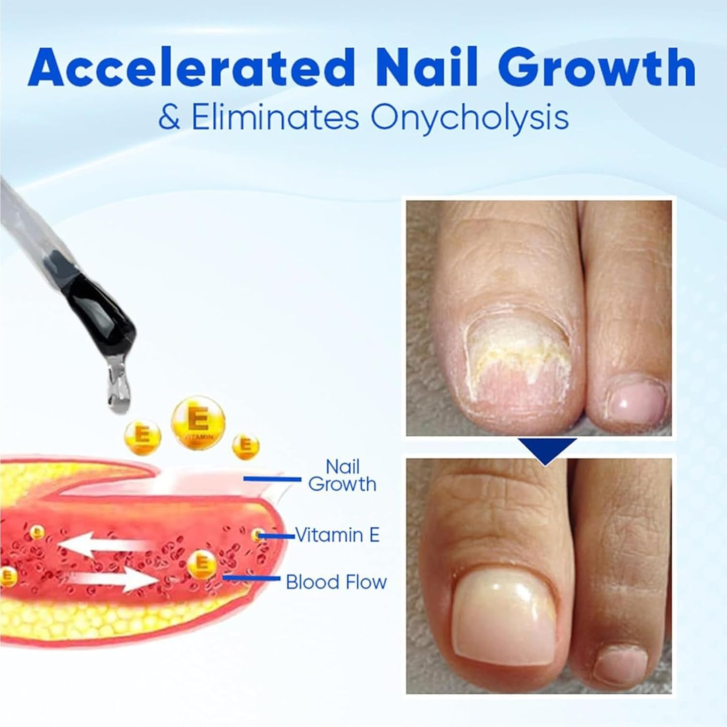 Nail Growth Oil, Service for Damaged Fingernails, Natural Hardener, Strengthening Ampoule, Restores Thin Nails, Revitalizes Dry Cuticles, Ideal for Hand Care and Skin Nourishment