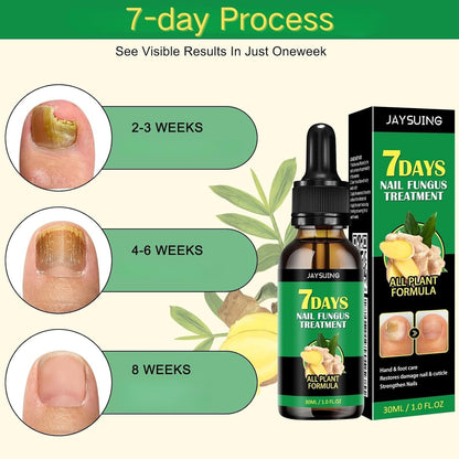 Ginger Nail Serum Solution, Ginger Cuticle Care Oil for Nails (2 PCS)
