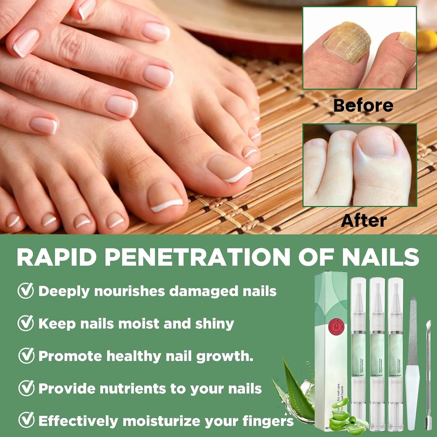 3 Pieces Nail Care Oil Pen, Nail Care Oil Pen Nourishing, Oil Pen for Nail Care, with Tea Tree Oil, Vitamin and Aloe Vera, Deeply Moisturizes and Nourishes