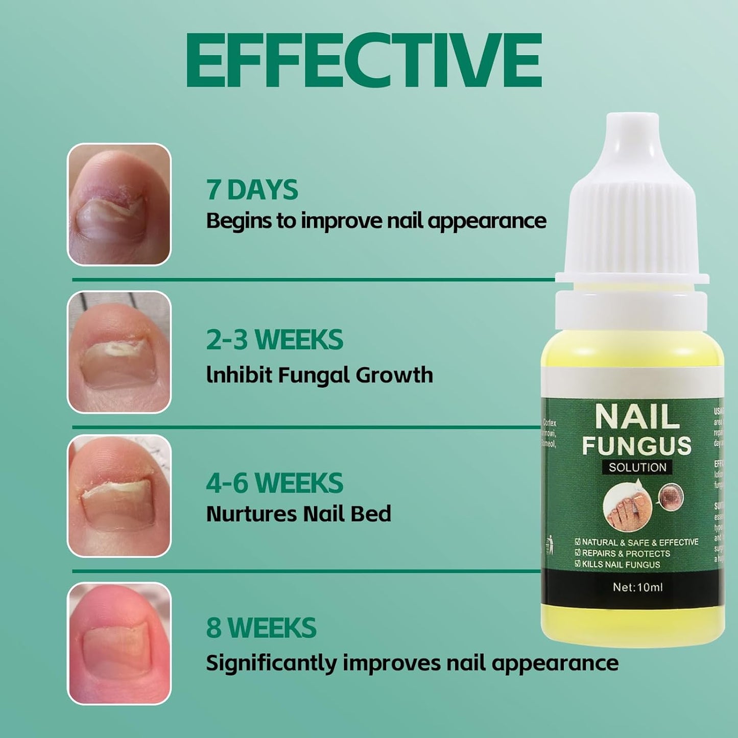 Apooliy Toenail Fungus Treatment，Nail Remedy Care for Damaged Nails and Appearance of Discolored，Nail Strengthener