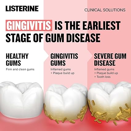 Listerine Clinical Solutions Gum Health Antiseptic Mouthwash, Antigingivitis & Antiplaque Oral Rinse Helps Prevent Buildup & Kills Germs for Healthier Gums, ICY Mint, Twin Pack, 1 L, 2 Pack