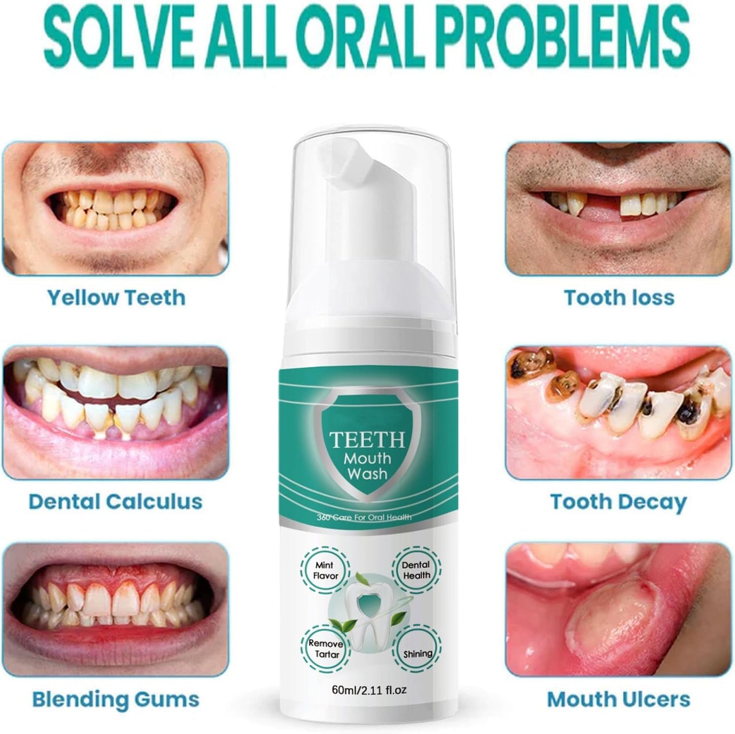 Jorondy Teeth Mouthwash, Teeth Whitening Mousse Foam, Deeply Cleaning Stain Removal Teeth Whitening Toothpaste, Mouth Wash Water, Oral Care Fresh Breath 60ml (2 Pack)