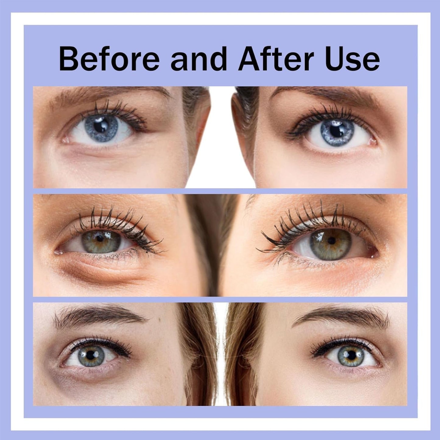 Eyelift Device, Puffy Eye Bags In 21 Days, Eye Bag Remover Glasses for Remove Dark Circles, Puffy Eyes, Relax Eyes Strain (White)