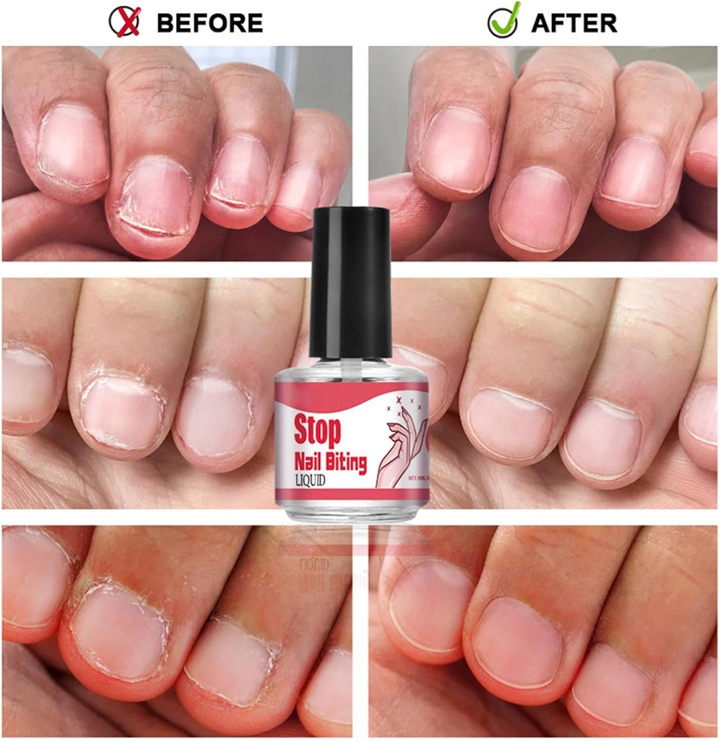 Anti Nail Biting Polish For Kids Adults, 10ML Nail Biting Treatments, Anti Bite Nail Polish, Thumb Sucking Stop, Bitter Taste, Safe Effective, Non-Glossy Invisible Coating for Nail Care