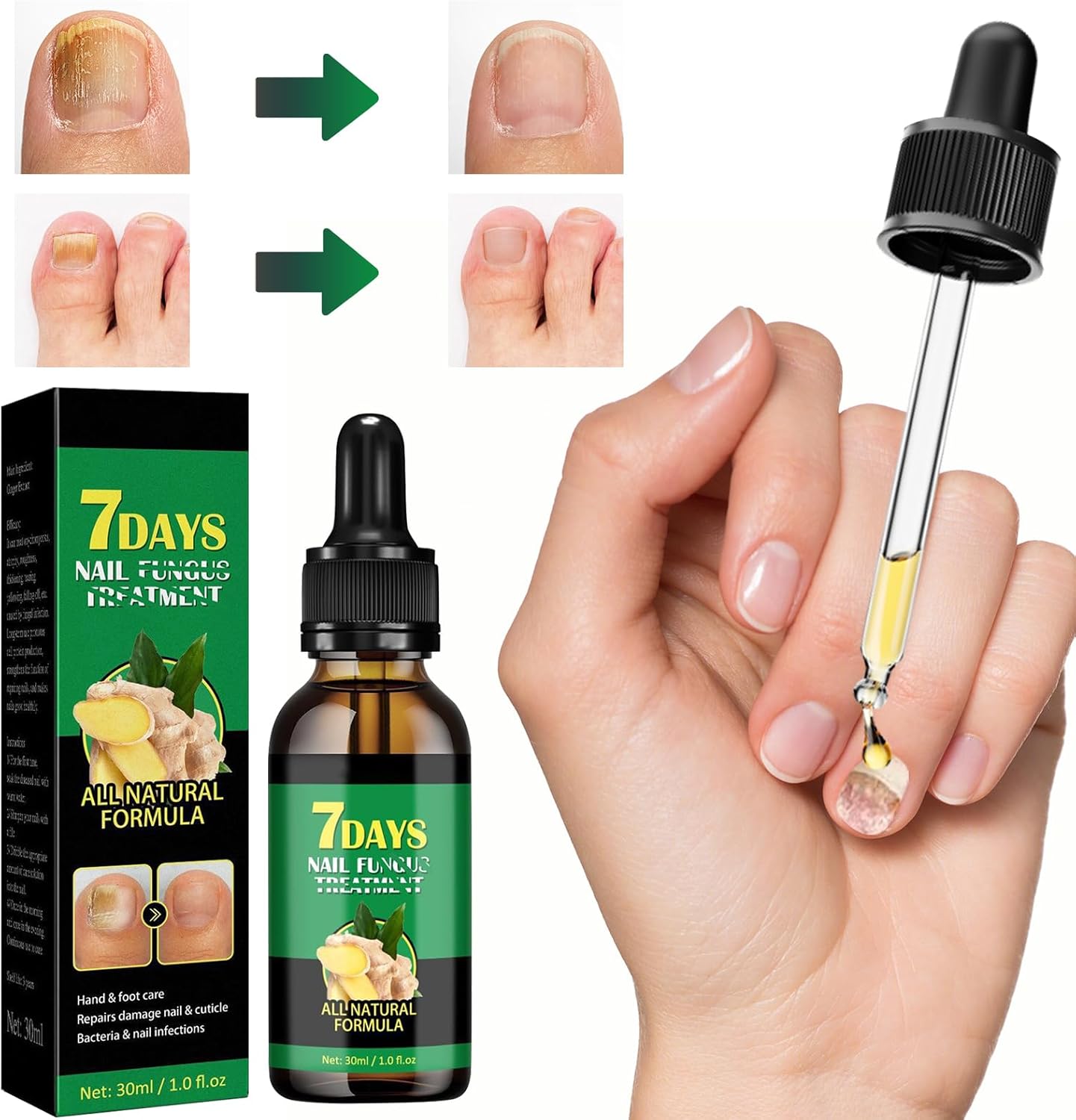 Ledeak Siero per Unghie Allo Zenzero, 30ml Ginger Nail Growth Serum, Cura delle Cuticole e Riparazione, Professionale Ginger Cuticle Care Oil For Nails per Unghie Danneggiate e Fragili