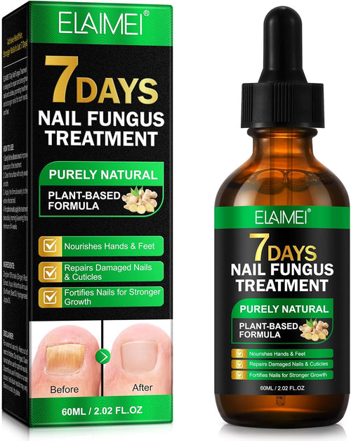7 Day Nail Fungus Treatment | Natural Plant-Based Nail Repair Oil with Ginger Extract | Strengthens & Nourishes Nails & Cuticles | Repairs Discolouration & Brittleness | Suitable for Hands & Feet | 60mL