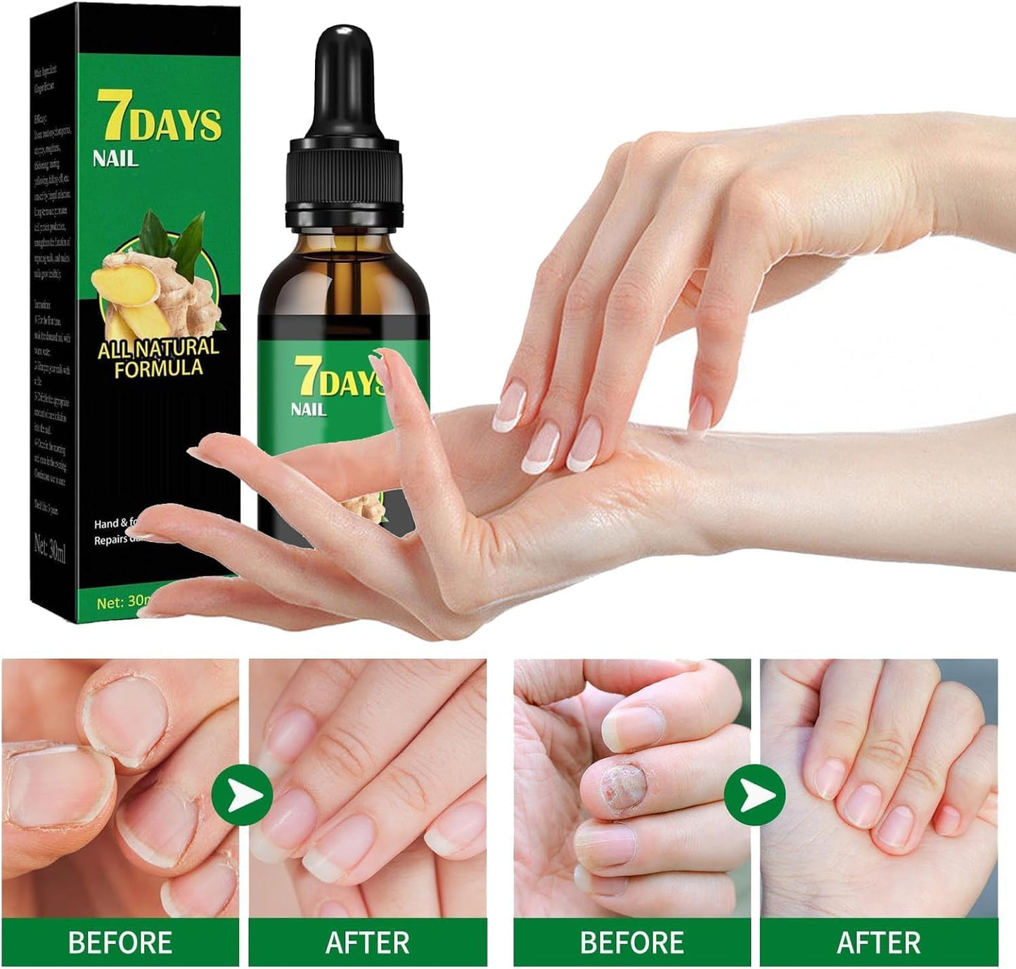 3 PCS 7 Days Ginger Nail Ginger Nail Treatment Nail Support Nail Care, Ginger Nail Growth Serum, Ginger Cuticle Care Oil for Nails, Nail Strengthener for Damaged Nails