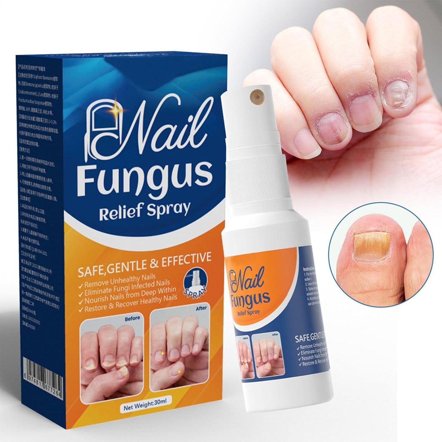 Nail Strengthener Spray, Toenail Care Treatments, 4.02x1.14in Gentle Long-Lasting Formula, Repair and Protect, Fast Absorbing Spray for Damaged Thickened Toenails Cares