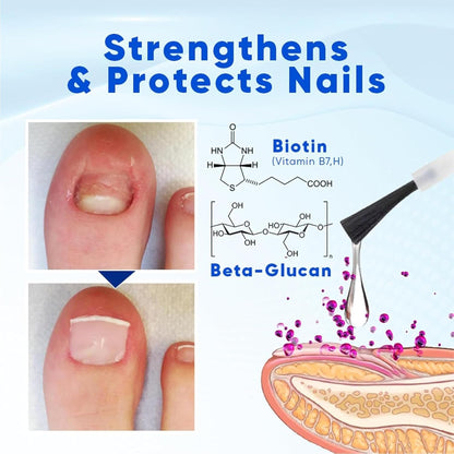 Nail Growth Oil, Service for Damaged Fingernails, Natural Hardener, Strengthening Ampoule, Restores Thin Nails, Revitalizes Dry Cuticles, Ideal for Hand Care and Skin Nourishment