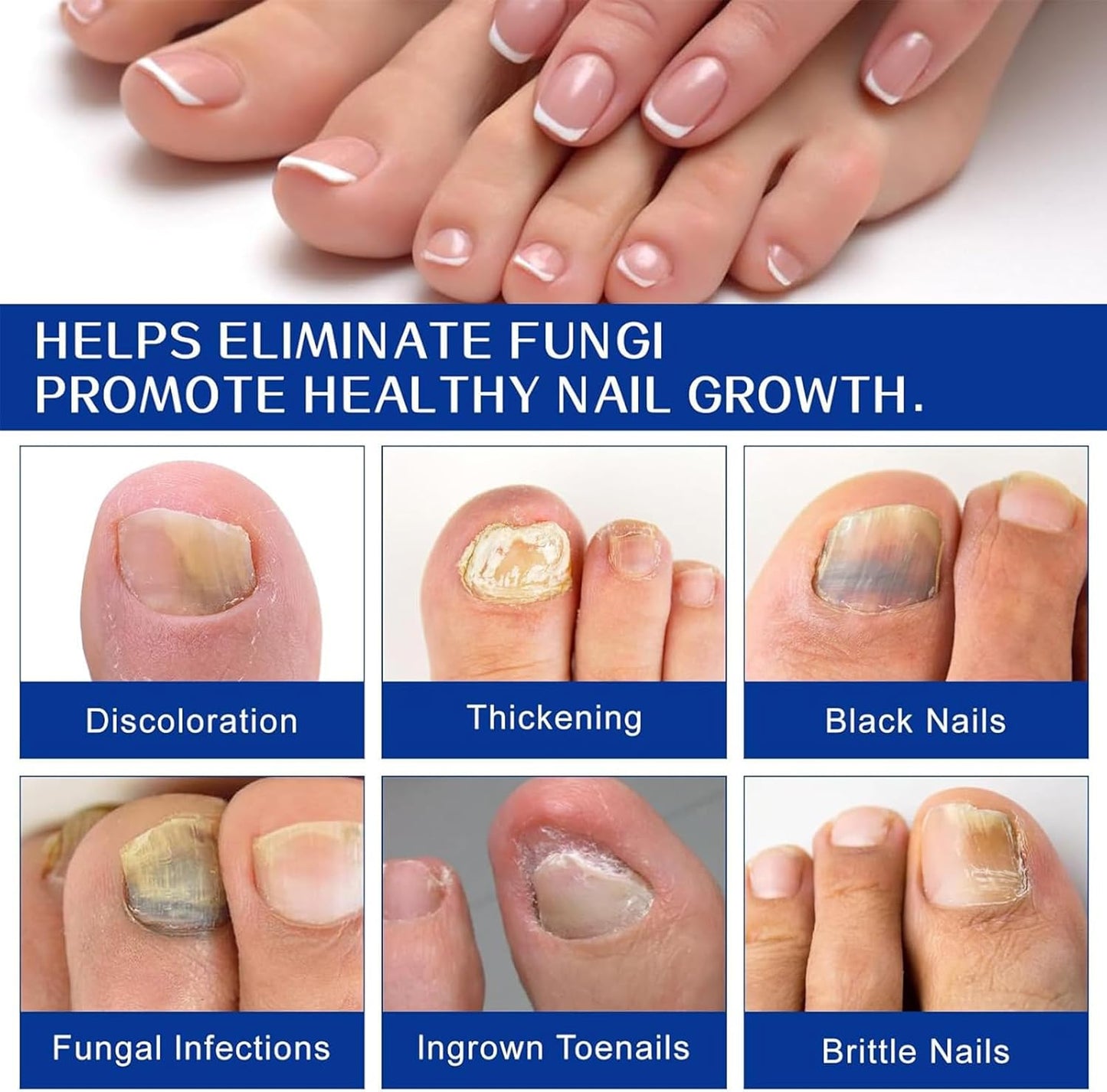 Fungal Nail Treatment Patches Extra Strong, Effectively Toenail Patches, Nail Care Anti Fungal Repair Patch for Natural Shine, Nails Patch Breathable (3box)