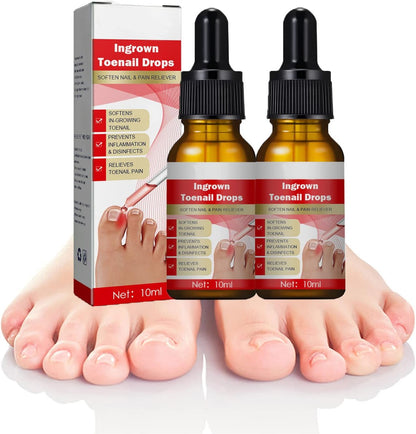 Nailhelper Ingrowth Toenail Correction Oil, Ingrown Toenail Drops, Nail & Cuticle Care, Ingrown Toenail Tool for Nail Repair (2pcs)