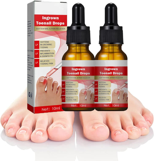 Nailhelper Ingrowth Toenail Correction Oil, Ingrown Toenail Drops, Nail & Cuticle Care, Ingrown Toenail Tool for Nail Repair (2pcs)