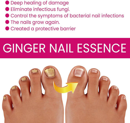 Nail Hardener, Nail Nutrient Oil, 10 ml Natural Cuticle Oils Repair Softener, Optimal Nail Revitalization, for Foot Care, Fingernails, Yellow Toenail, Men Ingrown, Women and