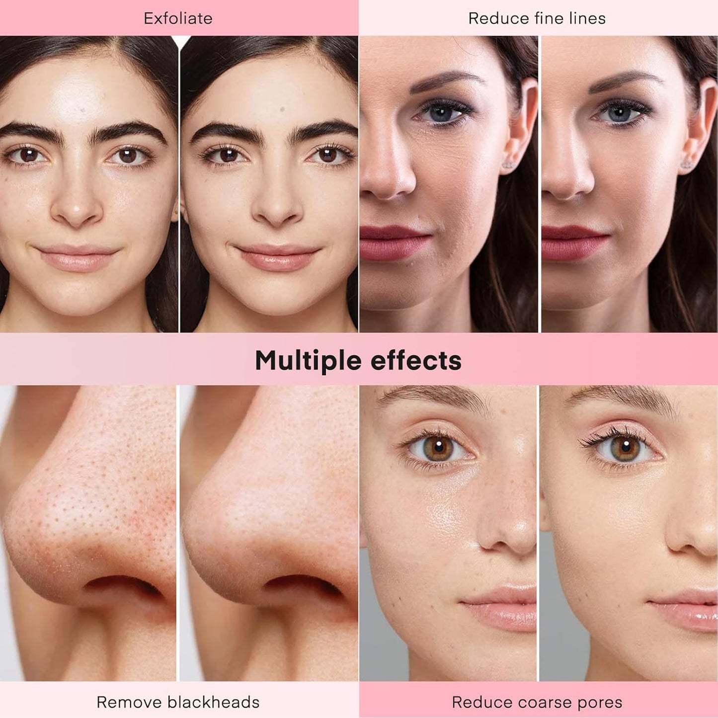 TwoWin 3 in 1 Face Machine for Facial Skin Care, Professional Suction Power Facial Device Equipment, 65-68cmHg Facial Skin Care Salon Equipment Removal & Spray