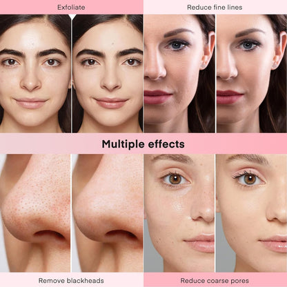 TwoWin 3 in 1 Face Machine for Facial Skin Care, Professional Suction Power Facial Device Equipment, 65-68cmHg Facial Skin Care Salon Equipment Removal & Spray