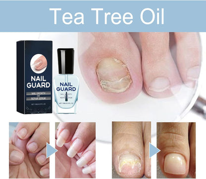 Nail Growth Oil, Service for Damaged Fingernails, Natural Hardener, Strengthening Ampoule, Restores Thin Nails, Revitalizes Dry Cuticles, Ideal for Hand Care and Skin Nourishment