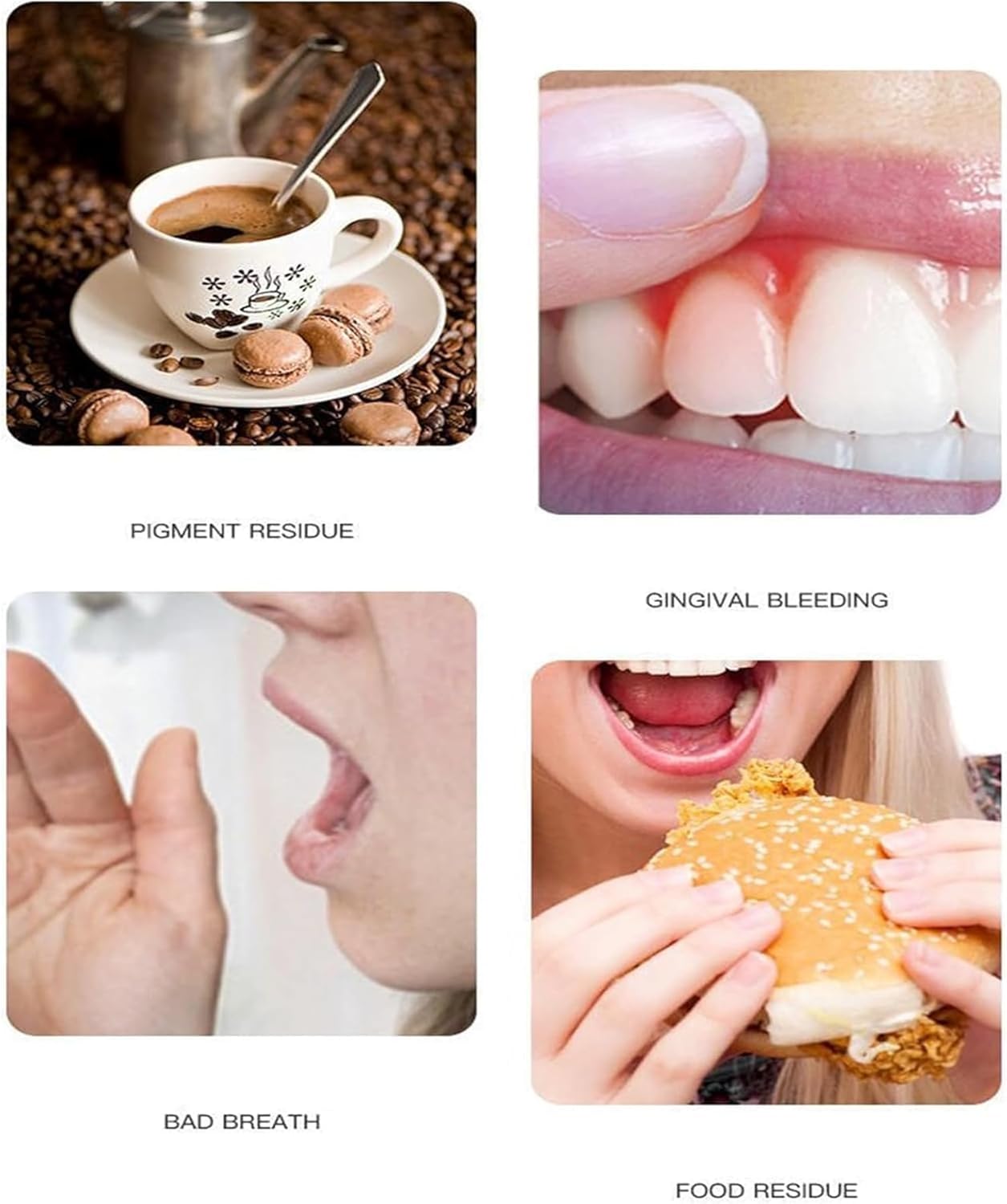 Acssart Toothpaste,Acssart Radiant Whitening Toothpaste,Niacinamide Whitening Toothpastes,Repair and Protect Teeth,Remove Tooth Stains,Daily Oral Care (2)