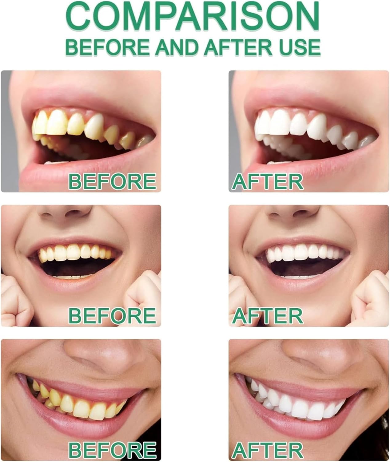 Acssart Toothpaste,Acssart Radiant Whitening Toothpaste,Niacinamide Whitening Toothpastes,Repair and Protect Teeth,Remove Tooth Stains,Daily Oral Care (2)